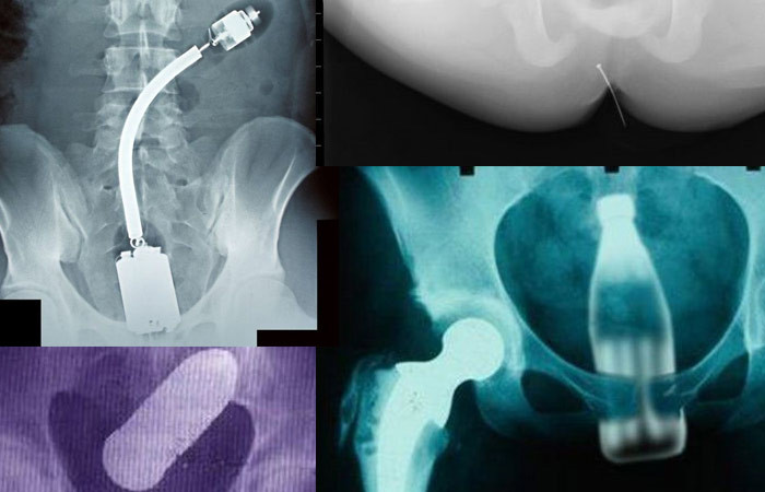 Bastonul de politie folosit ca vibrator! Vezi ce nici prin cap nu iti trece