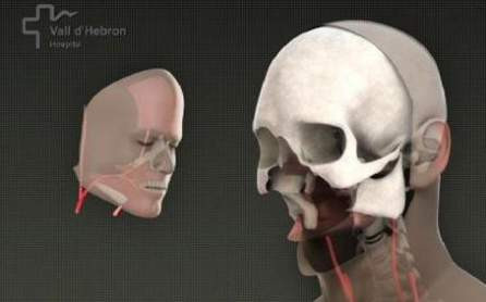 Premiera medicala in SUA: o femeie a primit un transplant total de fata