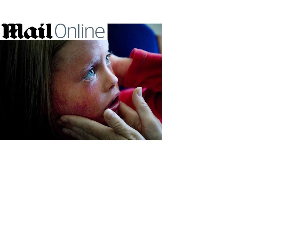 Caz uimitor! Isi schimba pielea de 14 ori pe zi!