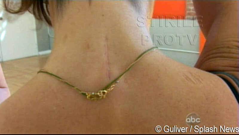 Jennifer Grey din Dirty Dancing a aflat ca are cancer la Dansez pentru tine