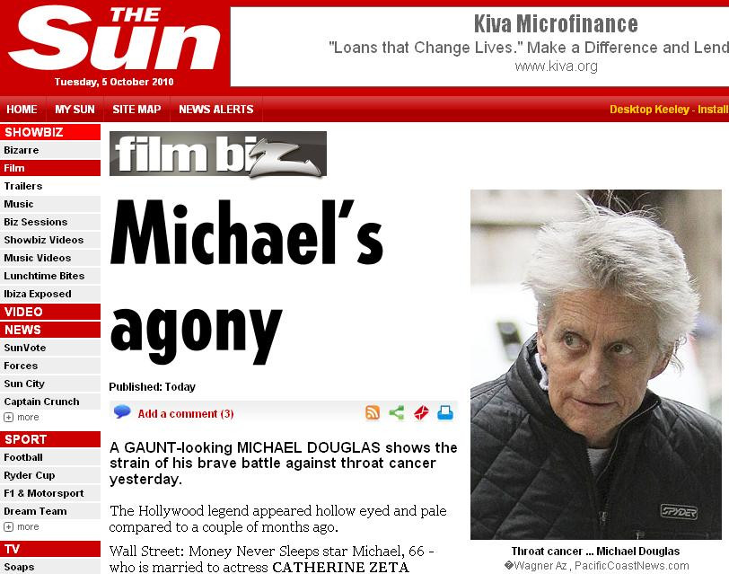 Michael Douglas, doborat de tratamentul agresiv impotriva cancerului