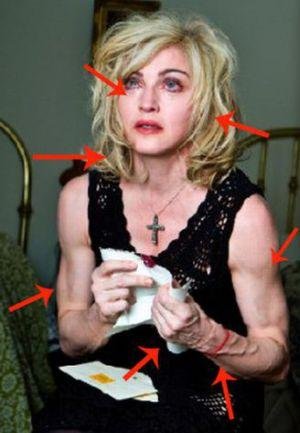 Madonna