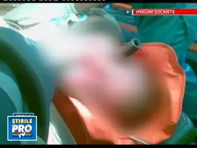 IMAGINI SOCANTE! A murit dupa ce o teava i s-a infipt in ochi