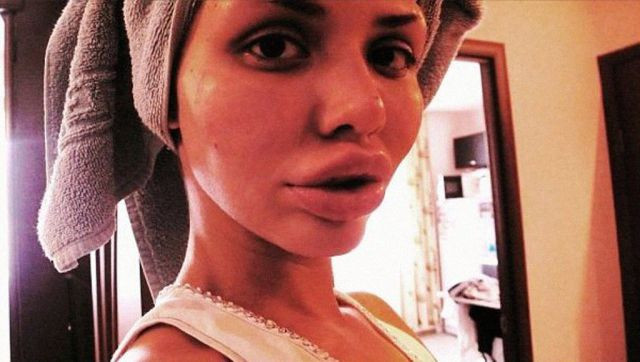 Uite cum arata pentru ca nu a stiut sa spuna STOP injectiilor cu silicon