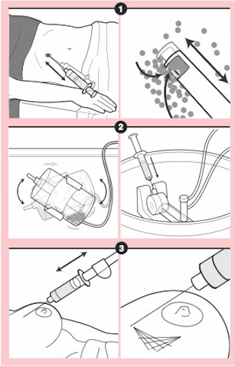 Etapele crearii tesutului adipos regenerativ
