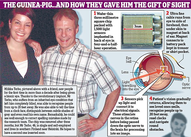 Descoperire revolutionara! Ochiul bionic care reda vederea nevazatorilor