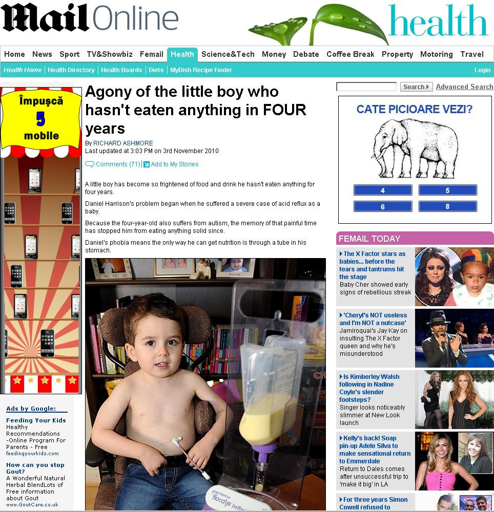 Copilul caruia ii e frica de alimente! E hranit prin buric, de 4 ani !