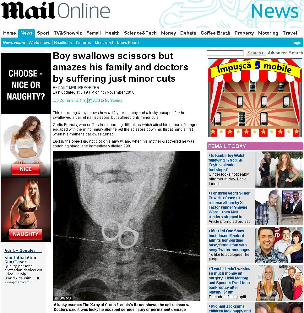 Radiografie soc! A scapat cu rani minore dupa ce a inghitit un foarfece