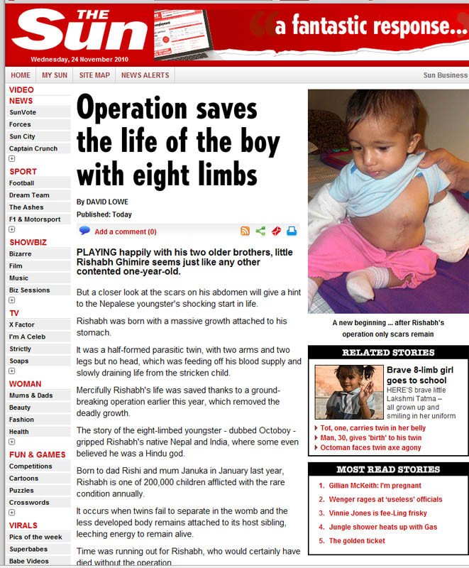 Copil cu 8 membre, salvat de medici! In 5 ore i-au taiat patru dintre ele