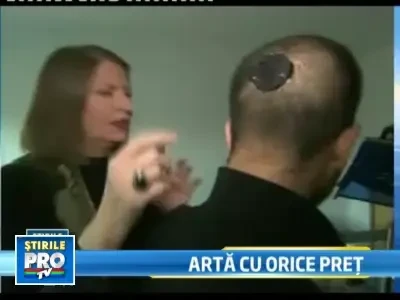 Si-a implantat o camera foto in cap!Vrea sa-si vada fiecare minut din viata