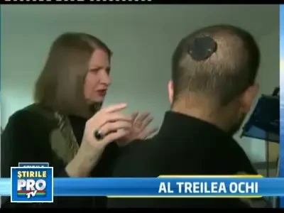 Si-a implantat o camera foto in cap!Vrea sa-si vada fiecare minut din viata