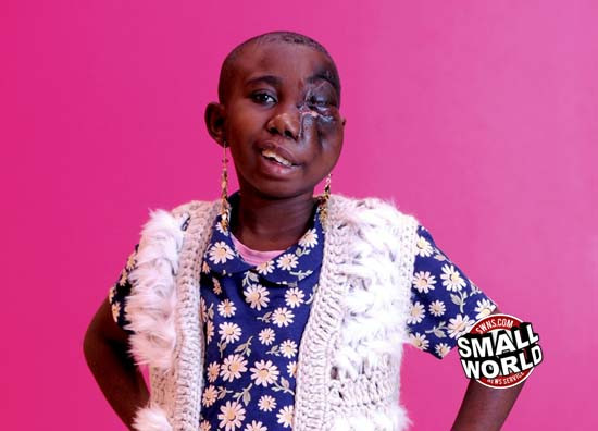 Au alungat-o crezand ca e posedata de diavol. Avea insa o tumoare gigant