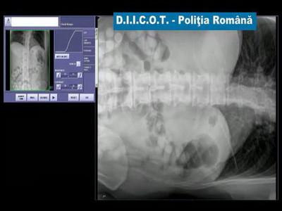 Un traficant a inghitit 1 kg de cocaina. Politia a pus mana pe probe