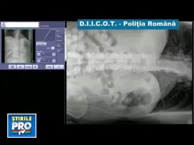 Un traficant a inghitit 1 kg de cocaina. Politia asteapta sa apara probele