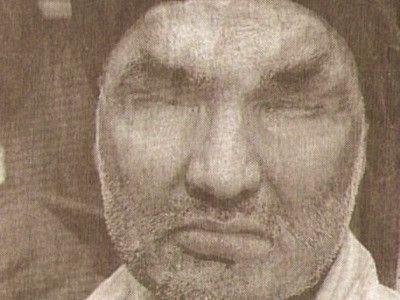 HORROR - Un barbat va fi ORBIT cu picaturi de acid sulfuric!