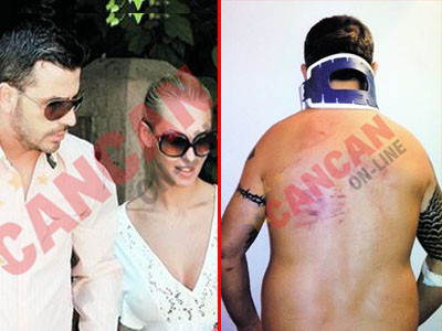 Iubitul Andreei Spataru si vanataile de dupa conflictul cu politistii. FOTO