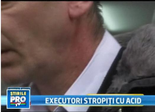 Barbatul care a stropit cu acid doi agenti fiscali: "Am fost provocat"