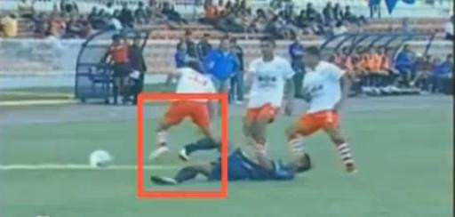 Te doare cand privesti! A intrat prin alunecare si i-a facut ZOB piciorul