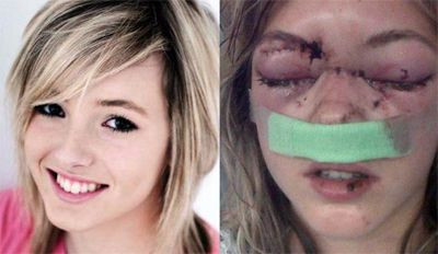 A desfigurat o atleta de 17 ani si a primit o amenda de numai 1000 de lei