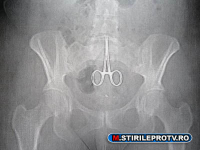 Analize fara radiatii. Cum functioneaza TERMOGRAFIA, cat dureaza si care este costul