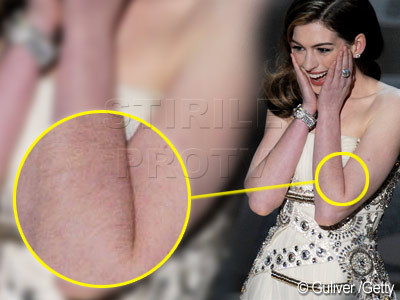 Anne Hathaway la Oscar 2011. Stilata, dar neepilata. FOTO