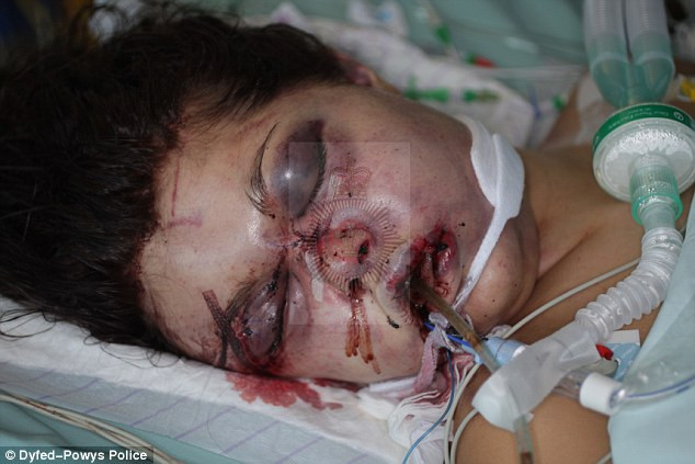 A batut-o pana ce a desfigurat-o. Medicii nu si-au dat seama ca e femeie