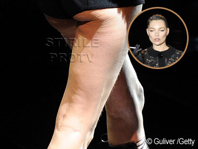 Kate Moss, la 37 de ani. Cu picioarele distruse de celulita pe scena