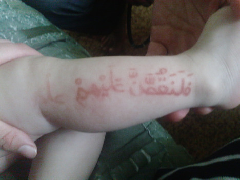 Urmasul lui Allah? Pe trupul unui copil apar pasaje din Coran. FOTO
