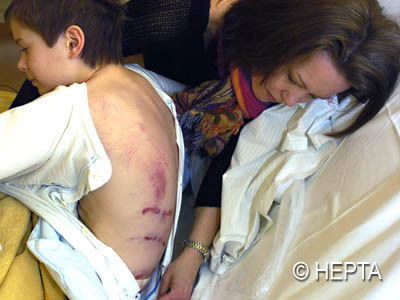 Evadare din barlogul ursului. Un copil a fugit cu picioarele sfasiate