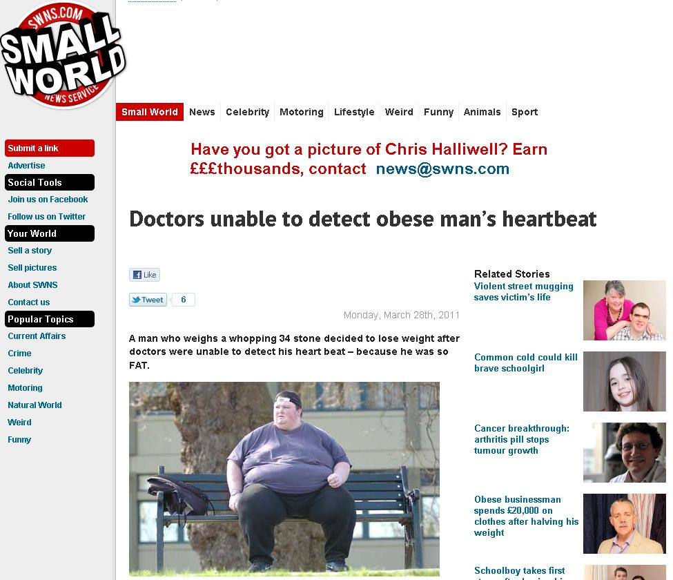 Medicii nu i-au putut localiza inima pentru ca este prea gras