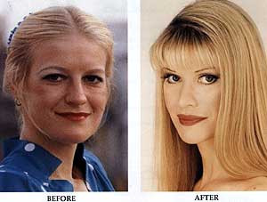 E reala? Femeia ce si-a facut cele mai multe operatii estetice din lume