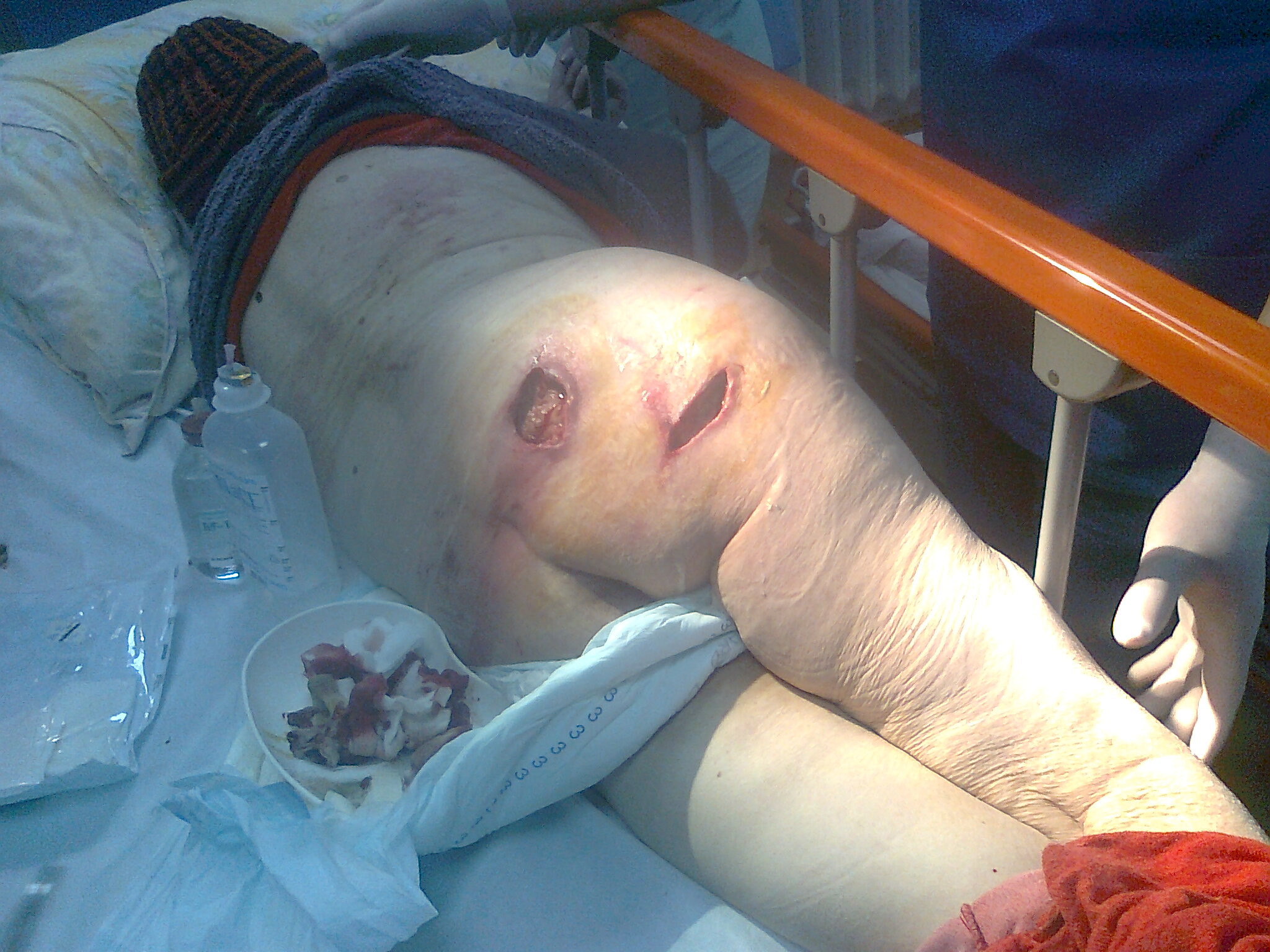 Pacienta Spital Buftea