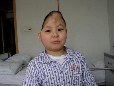 A ramas fara jumatate de craniu dupa un accident STUPID!