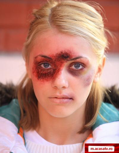 Cu chipul desfigurat! Vezi poze cu Andreea Patrascu din “Iubire si onoare”