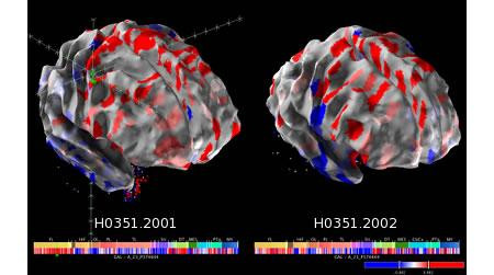 Vezi cum arata cea mai detaliata harta a creierului uman