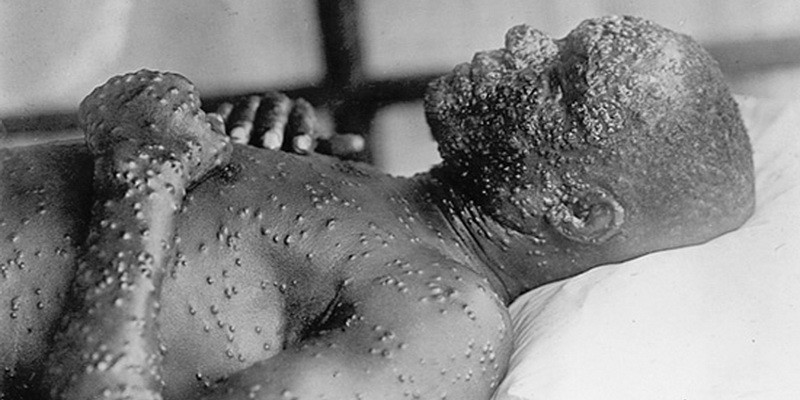 O noua amenintare terorista - virusul care a ucis mai mult decat razboaiele e inca in laboratoare