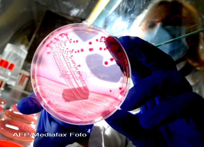 Cel mai contaminat loc din casa ta. Unde ai 8.000 de bacterii pe centimetrul patrat