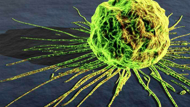 Cancerul impotriva cancerului. Medicii au gasit o tumoare mutanta care "mananca" celulele bolnave