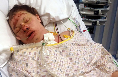 Mereu tanara. Povestea femeii care isi reseteaza memoria la 24 de ore. Se crede mereu copil