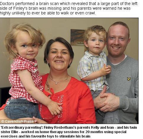 Nascut cu o jumatate de creier, un copil a reusit sa mearga datorita jucariei preferate