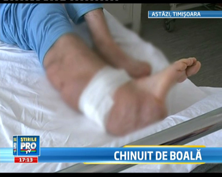 Interventie complexa la Timisoara: operat pentru o afectiune cumplita, "picior de elefant"