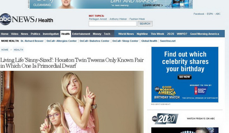 Lectie de supravietuire. Povestea gemenelor care au sfidat legile naturii si au uimit lumea medicala