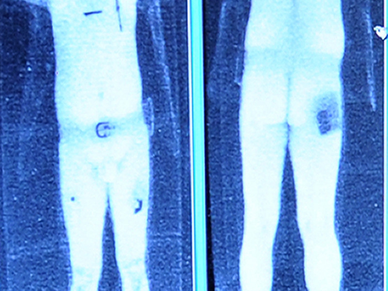 Teroristii planuiesc sa arunce in aer avioanele cu bombe ascunse in propriul corp
