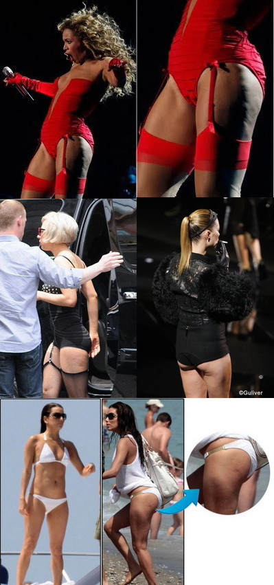 Celulita, un pericol pentru faima? Voteaza vedeta care a pierdut lupta cu "inamicul"