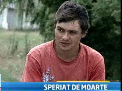 Barbatul care se teme de soare. O explozie la locul de munca i-a schimbat total viata