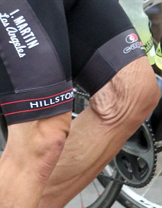 Cum a ajuns pielea unui actor de la Hollywood sa arate atat de urat. GALERIE FOTO