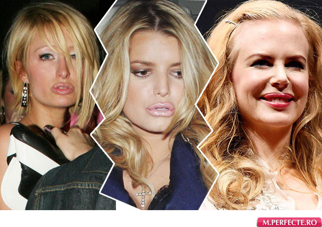 Topul vedetelor care si-au distrus buzele cu operatii estetice