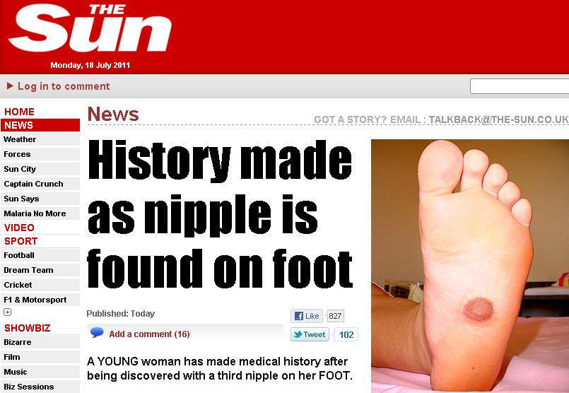 Aparitia din talpa cu care o tanara a socat lumea medicala FOTO