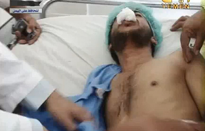 Atrocitate incredibila in Yemen.I-au taiat limba si au aratat-o la televiziunea de stat.VIDEO SOCANT