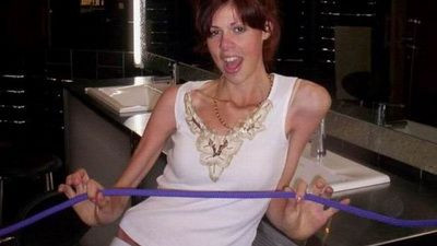 Anorexia distruge vieti. Vezi cele mai impresionante cazuri ale unor adolescente! FOTO